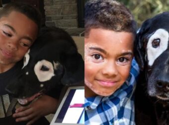 Η ιστορία που συγκινεί το διαδίκτυο: 8χρονο αγόρι και σκύλος έχουν την ίδια πάθηση και γίνονται κολλητοί